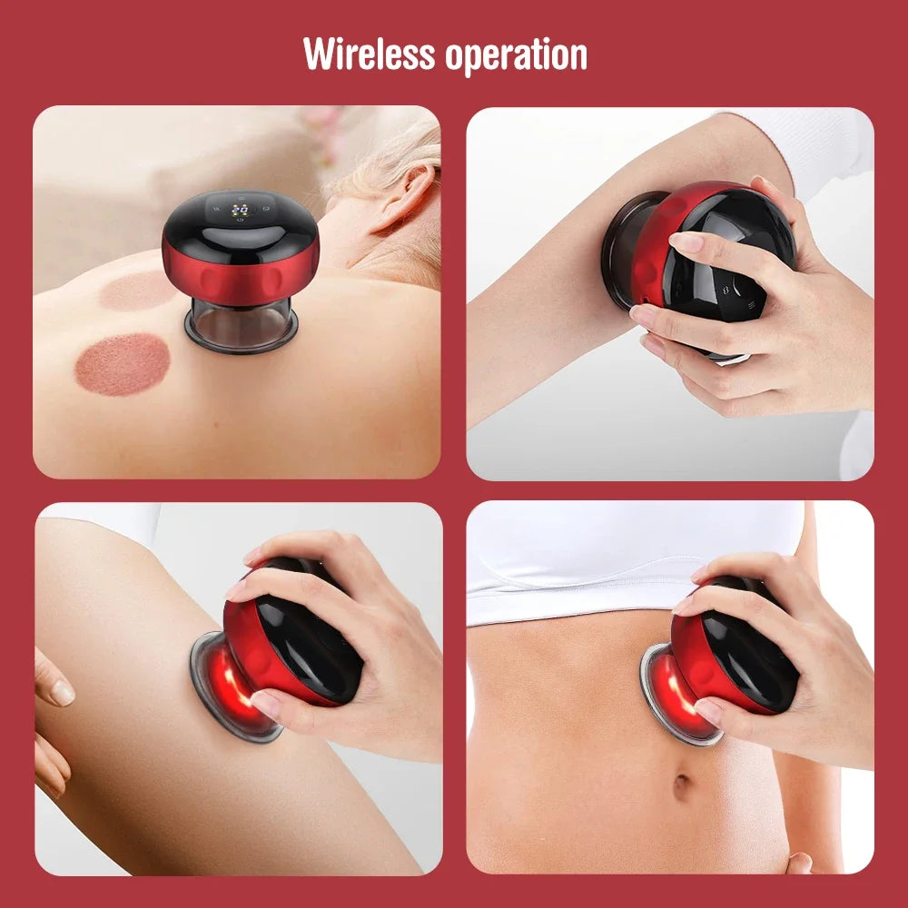 Smart Electric Heated Cupping Massager – Deep Suction Therapy for Back, Neck & Body Pain Relief
